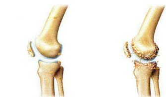 Symptoms based on knee-induced analysis