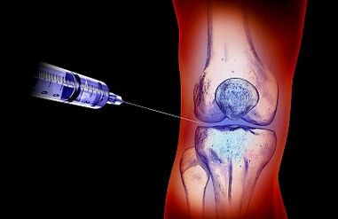 Treatment plan for knee joints