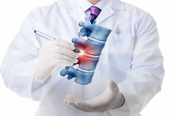 Spinal lesions caused by thoracic osteochondrosis