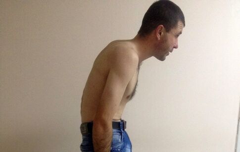 Ankylosing spondylitis can cause low back pain for years